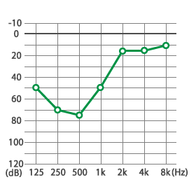 娘が低音難聴になりました。病院に行っても良くならず、新たに鍼灸治療をはじめました。