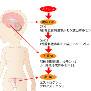 ストレスが女性ホルモンを乱し不妊症へとつながる