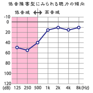 低音難聴にご用心！ 低音障害型感音性難聴の治療法