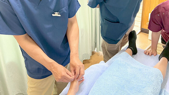 突き指の鍼治療