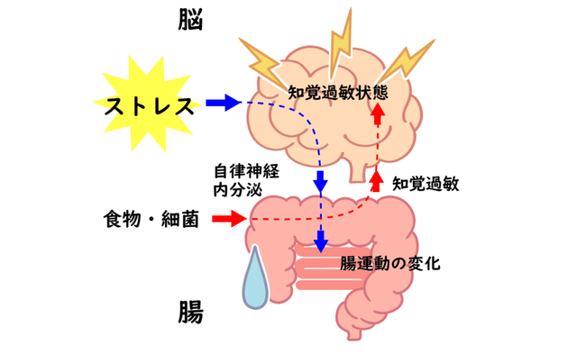 ストレスと過敏性腸症候群